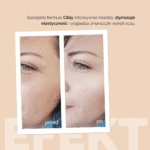 KREM POD OCZY PRZECIW ZMARSZCZKOM I OBRZĘKOM 30ML - obrazek 5