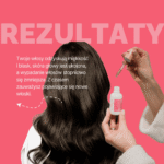 SERUM PRZECIW WYPADANIU WŁOSÓW Z EFEKTEM STYMULACJI WZROSTU - 30 ML - obrazek 3