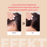SERUM PRZECIW WYPADANIU WŁOSÓW Z EFEKTEM STYMULACJI WZROSTU - 30 ML - obrazek 5